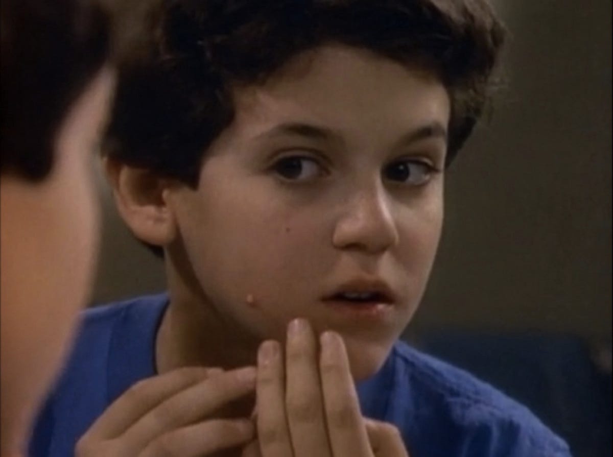 the wonder years kevin pimple scene